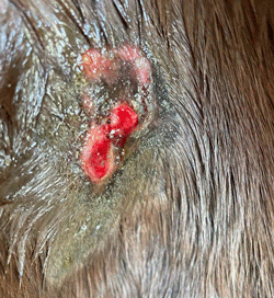 Sarcoids treated with Acess 