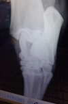 Xray of hock