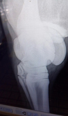 Xray of hock.